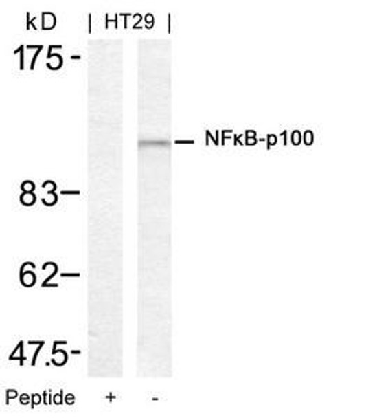 NFKB2 (Ab-872) Antibody (PACO23586)