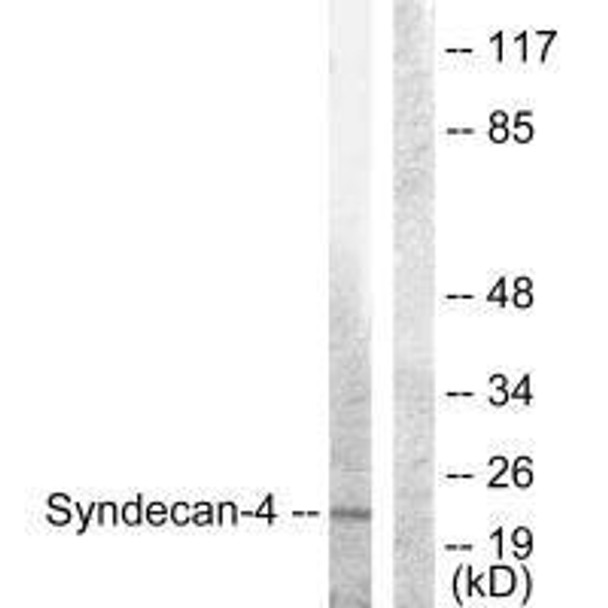 SDC4 (Ab-179) Antibody (PACO23618)