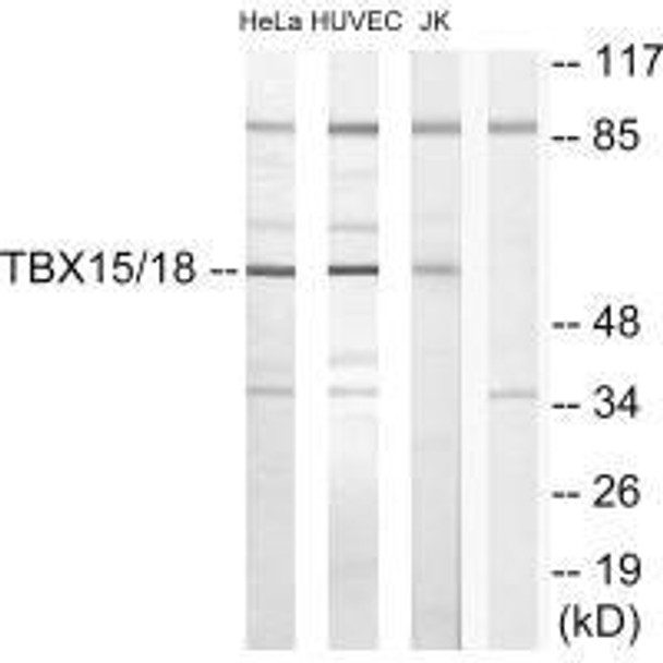 TBX15/TBX18 Antibody (PACO23730)