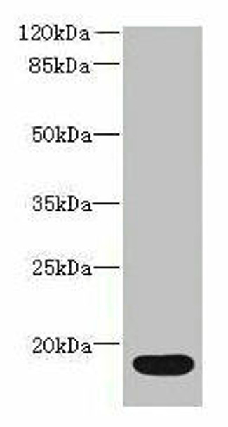 IL36RN Antibody (PACO40694)