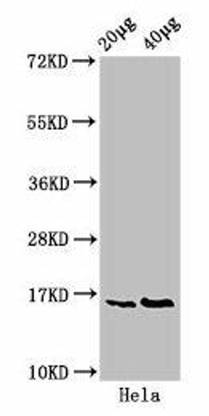 Phospho-HIST1H3A (S10) Antibody (PACO56570)
