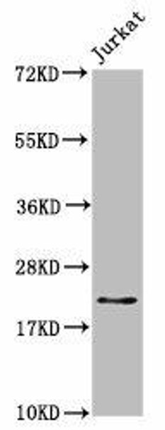 HIST1H1C (Ab-164) Antibody (PACO56682)