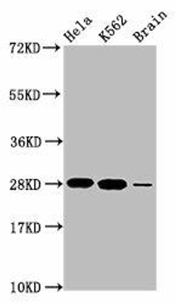 HIST1H1E (Ab-17) Antibody (PACO56694)