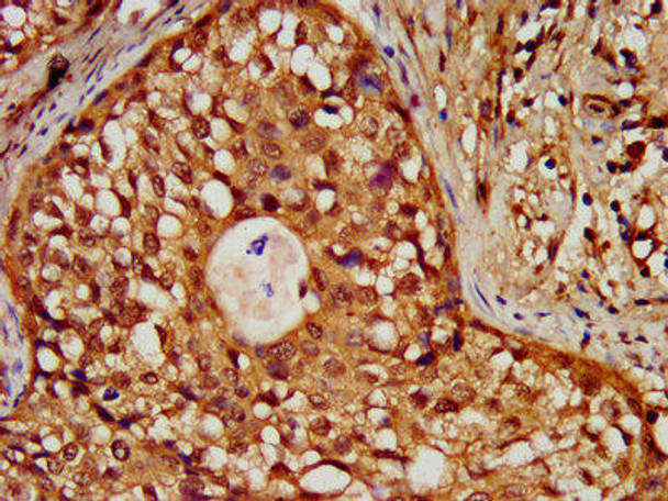 HIST1H3A (Ab-18) Antibody (PACO57642)