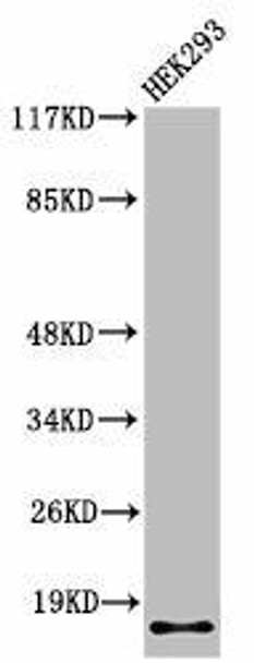 Cleaved-ITGA5 (E895) Antibody (PACO00047)