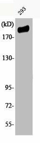 Phospho-IRS1 (S307) Antibody (PACO00224)