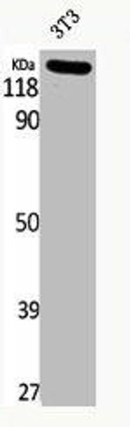 Phospho-JAK2 (Y1007) Antibody (PACO00227)