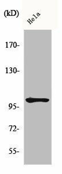 Phospho-NFKB1 (S907) Antibody (PACO00238)