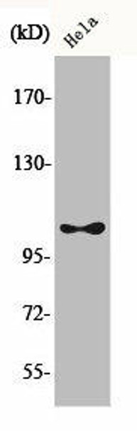 Phospho-EEF2K (S366) Antibody (PACO00302)