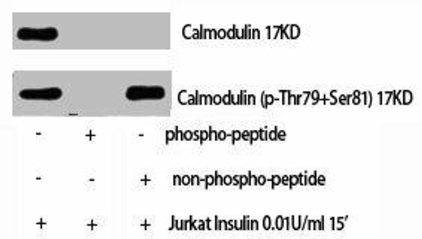 Phospho-CALM1 (T80/S82) Antibody (PACO00326)