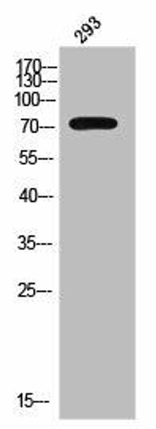 Phospho-CTNNB1 (Y654) Antibody (PACO02517)