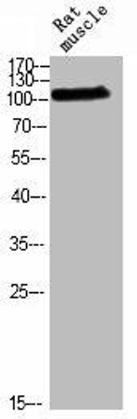 Phospho-RB1 (T826) Antibody (PACO03057)