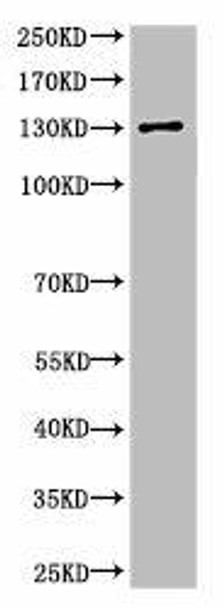 Cleaved-SPTAN1 (D1185) Antibody (PACO06043)