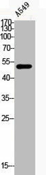 Phospho-CCNE1 (T395) Antibody (PACO06113)