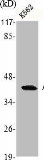 ACTB/POTEKP/ACTG1 Antibody (PACO06227)