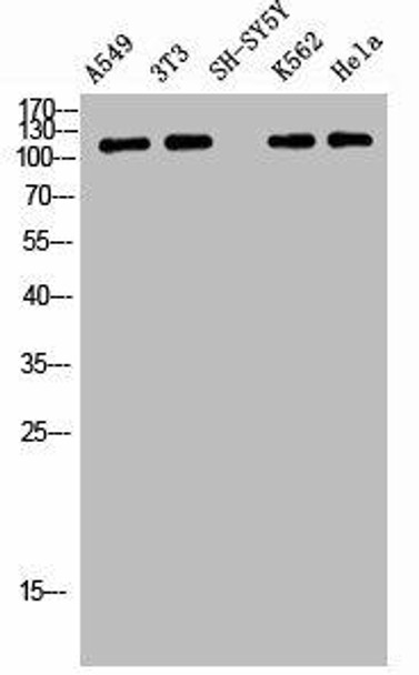 Phospho-TENC1 (Y483) Antibody (PACO06961)