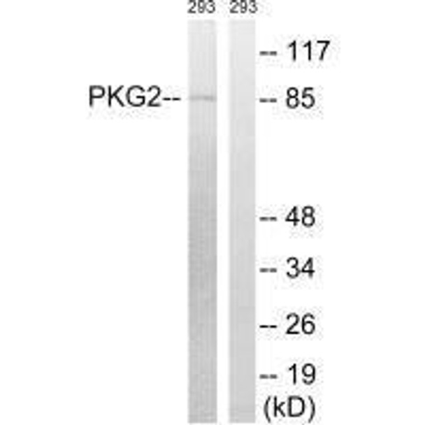 PRKG2 (Ab-126) Antibody (PACO21609)