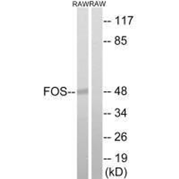 FOS (Ab-232) Antibody (PACO21614)