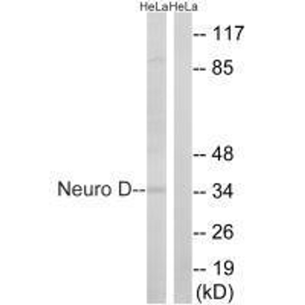 NEUROD1 (Ab-274) Antibody (PACO21628)