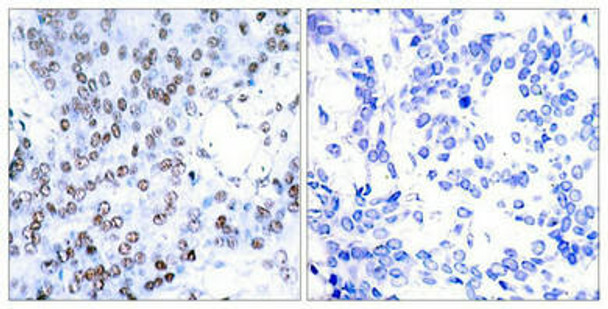 JUNB (Ab-79) Antibody (PACO22871)