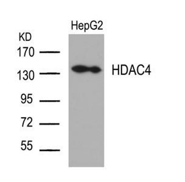 HDAC4 (Ab-632) Antibody (PACO22921)