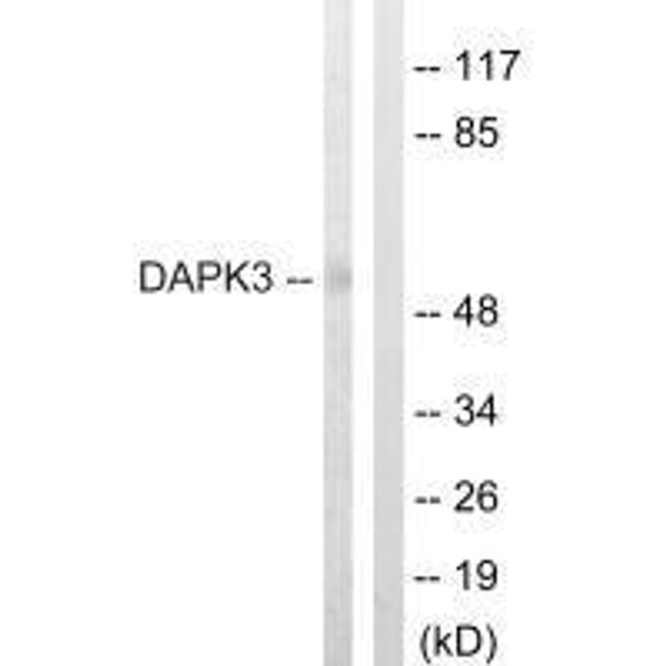 DAPK3 (Ab-265) Antibody (PACO23033)
