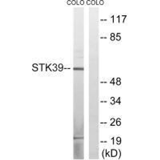 STK39 (Ab-311) Antibody (PACO23069)