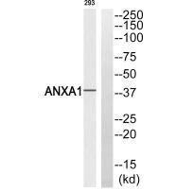 ANXA1 (Ab-21) Antibody (PACO23076)