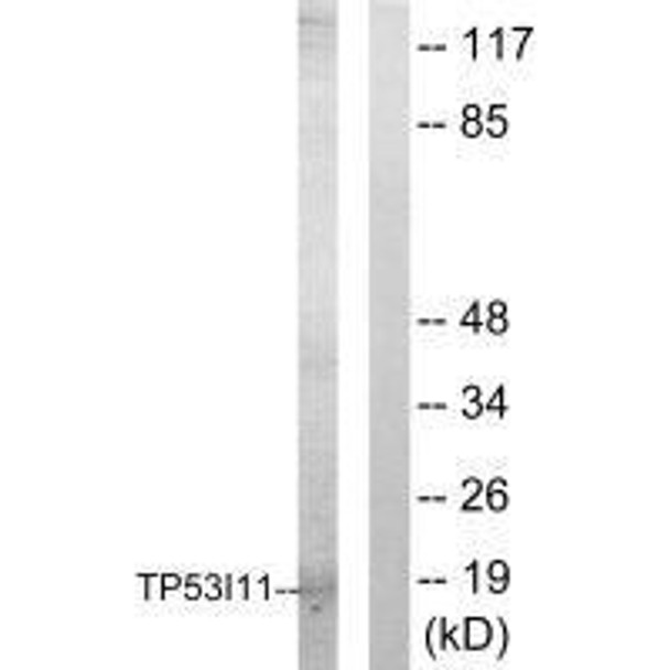 TP53I11 Antibody (PACO23162)