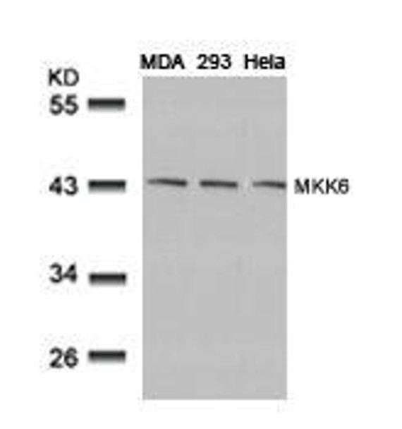 MAP2K6 (Ab-207) Antibody (PACO23561)