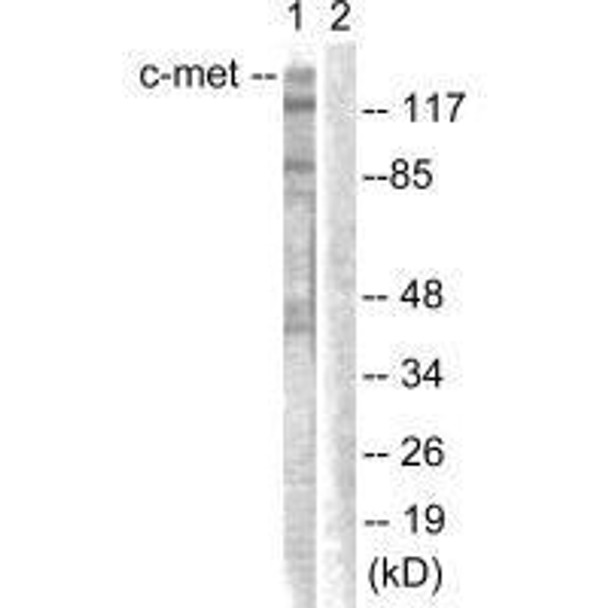 MET (Ab-1003) Antibody (PACO23616)