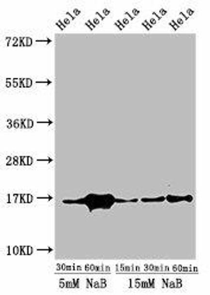 Acetyl-HIST1H3A (K23) Antibody (PACO56522)