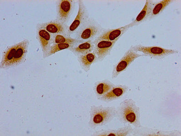 Acetyl-HIST1H1E (K63) Antibody (PACO56598)