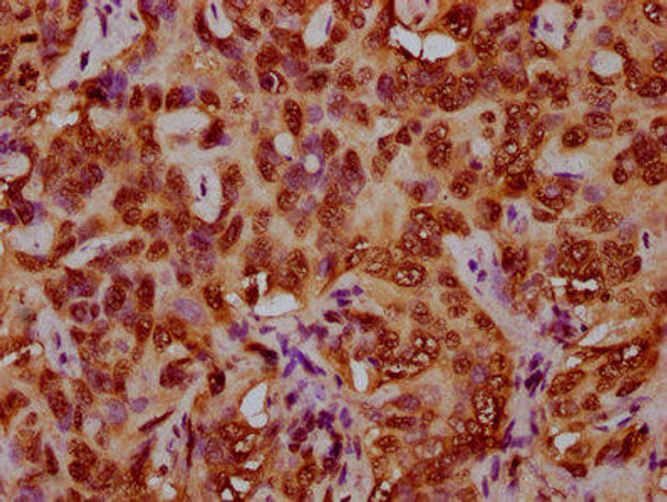 HIST1H4A (Ab-79) Antibody (PACO59612)