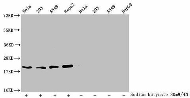 Acetyl-HIST1H1C (K84) Antibody (PACO61897)