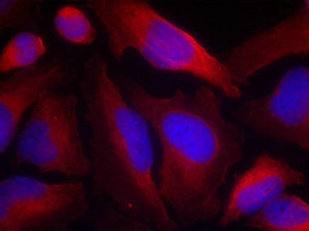 Phospho-TH (Ser19) Antibody (PACO23892)