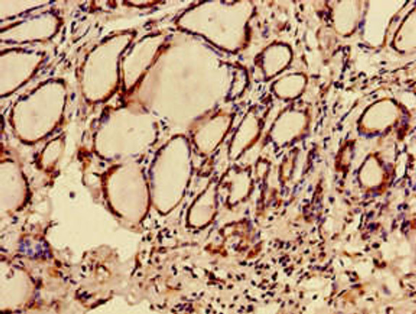 C12orf43 Antibody (PACO39558)