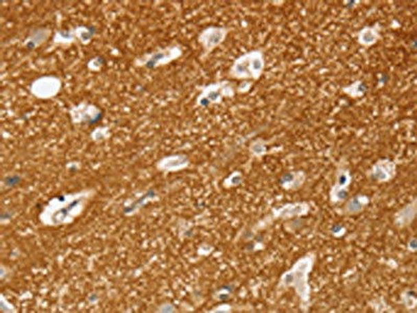 SLC25A13 Antibody (PACO17103)