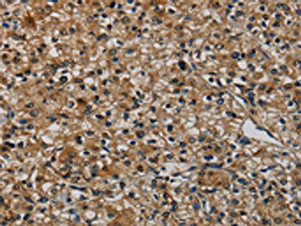 TP53INP1 Antibody (PACO20163)