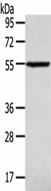 SLC16A11 Antibody (PACO20480)