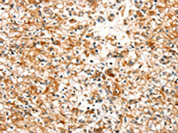 SLC25A12 Antibody (PACO20490)