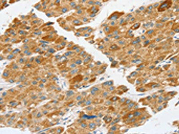 TP53I11 Antibody (PACO20734)