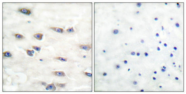 Phospho-NTRK1 (Tyr791) Antibody (PACO24083)