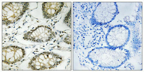 Phospho-ATR (Ser428) Antibody (PACO24216)