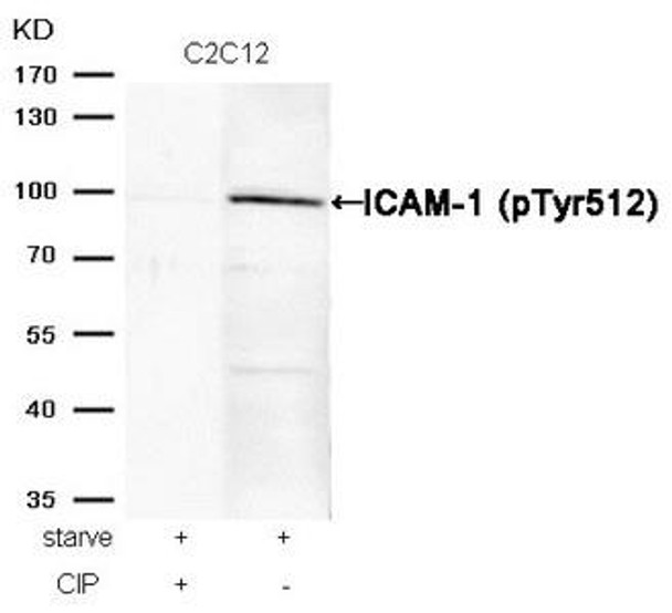 Phospho-ICAM1 (Tyr512) Antibody (PACO24253)