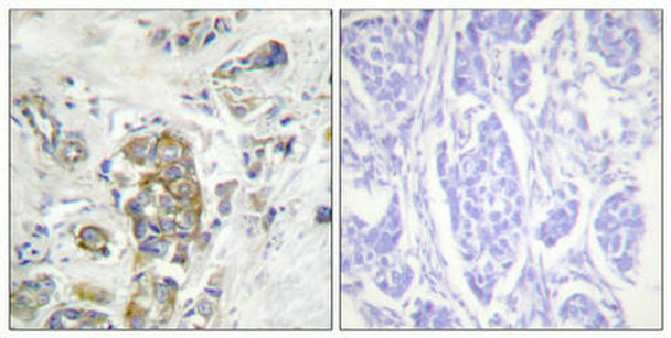 Phospho-ITGB4 (Tyr1510) Antibody (PACO24382)