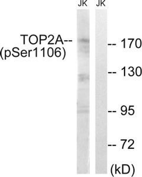 Phospho-TOP2A (Ser1106) Antibody (PACO24417)
