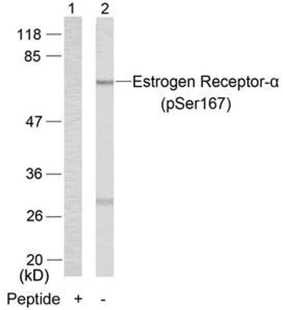 Phospho-ESR1 (Ser167) Antibody (PACO24449)