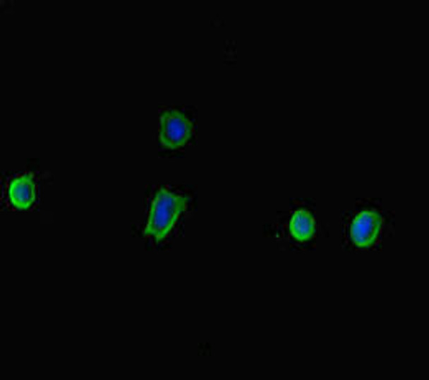 TP53INP2 Antibody (PACO46778)
