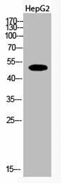 Acetyl-TUBA1A/TUBA1B/TUBA1C (K112) Antibody (PACO00072)